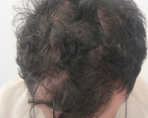 pedroantes pedroantes